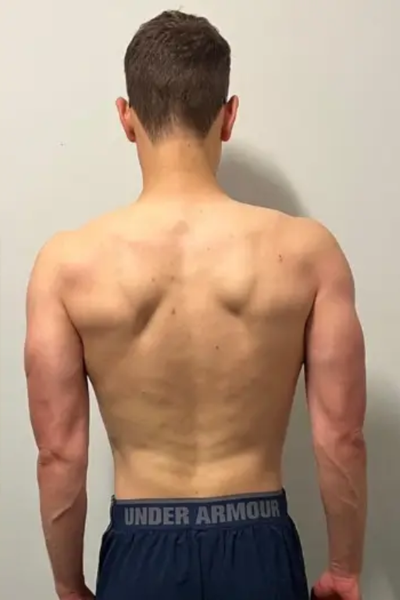 After transformation