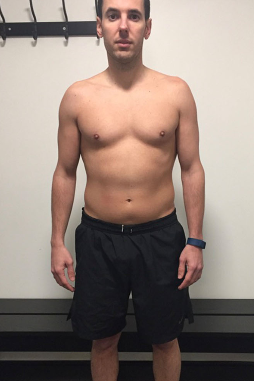 Before transformation