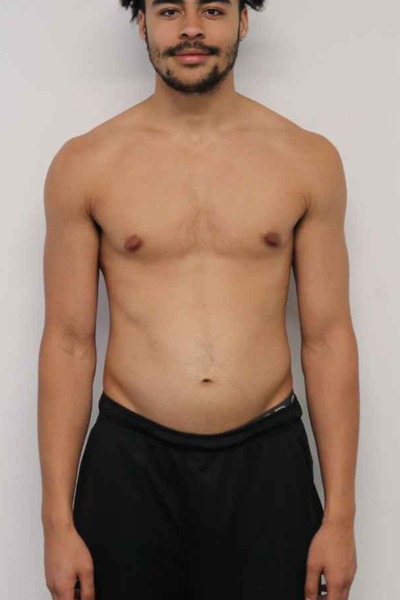 Before transformation