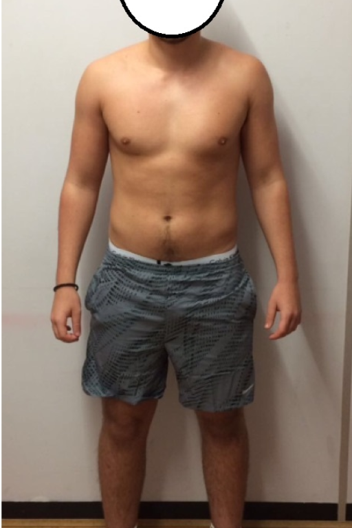 Before transformation