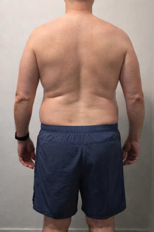 Before transformation