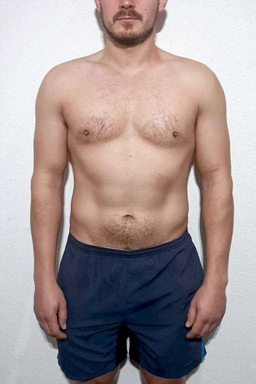 Before transformation