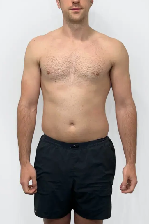 Before transformation