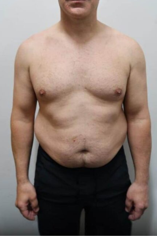 Before transformation