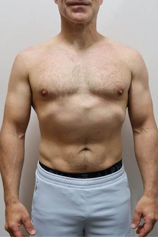 After transformation