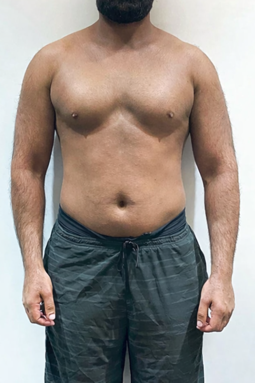 Before transformation