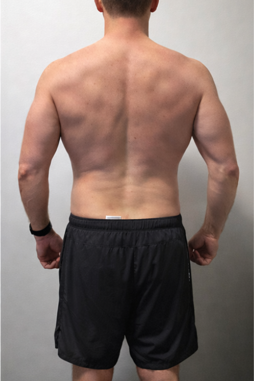 After transformation