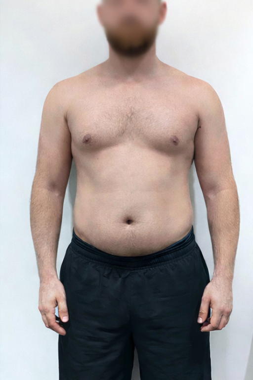 Before transformation