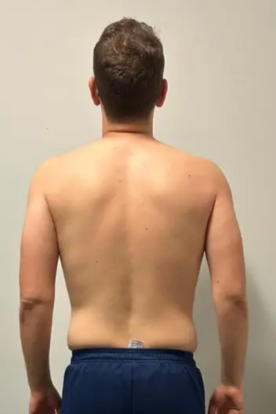 Before transformation